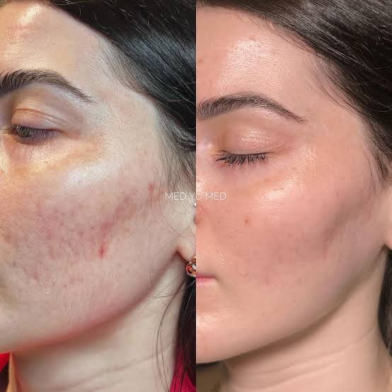 پک6تایی ساشه ریدل شات مدل کلاژن