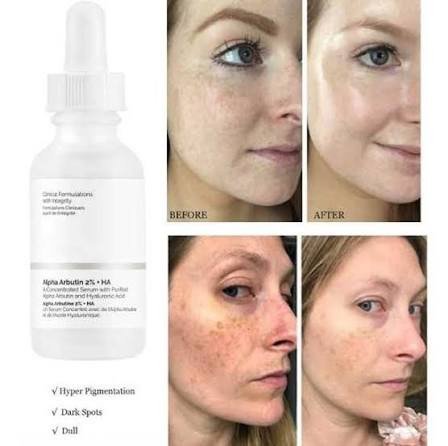 سرم ضدلک و روشن کننده آلفا آربوتین اوردینری