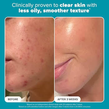 لایه بردار مایع ۲٪ BHA اسکین پرفکتینگ پائولا چویس